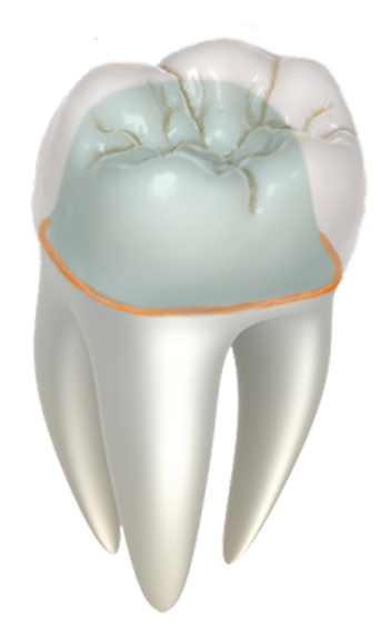 crown-11