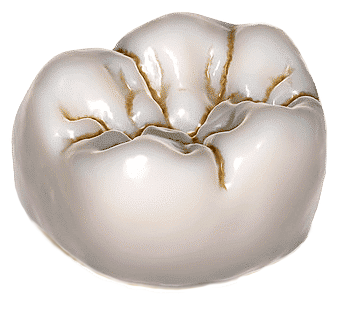 crown-2