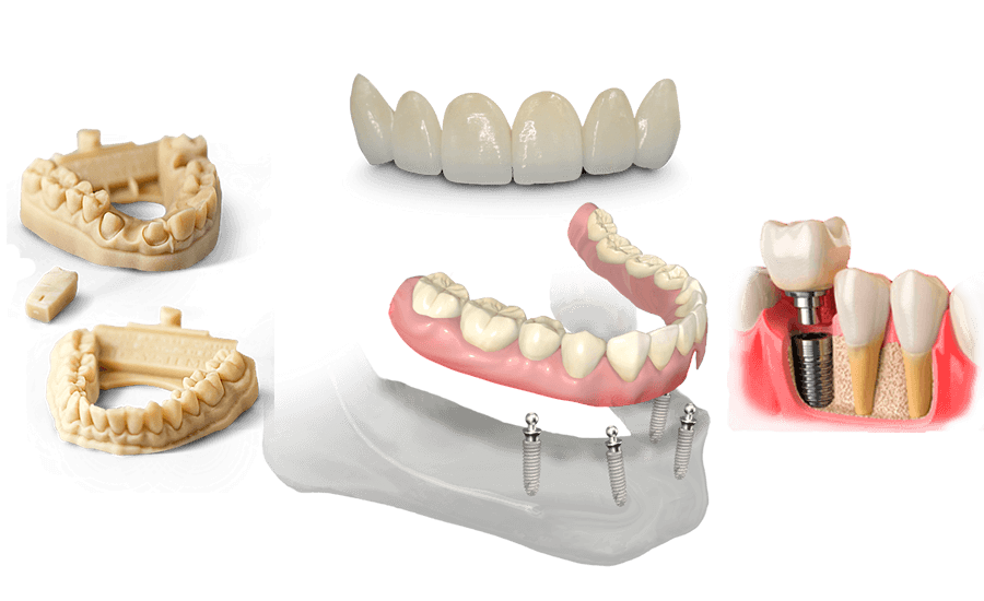 product-1